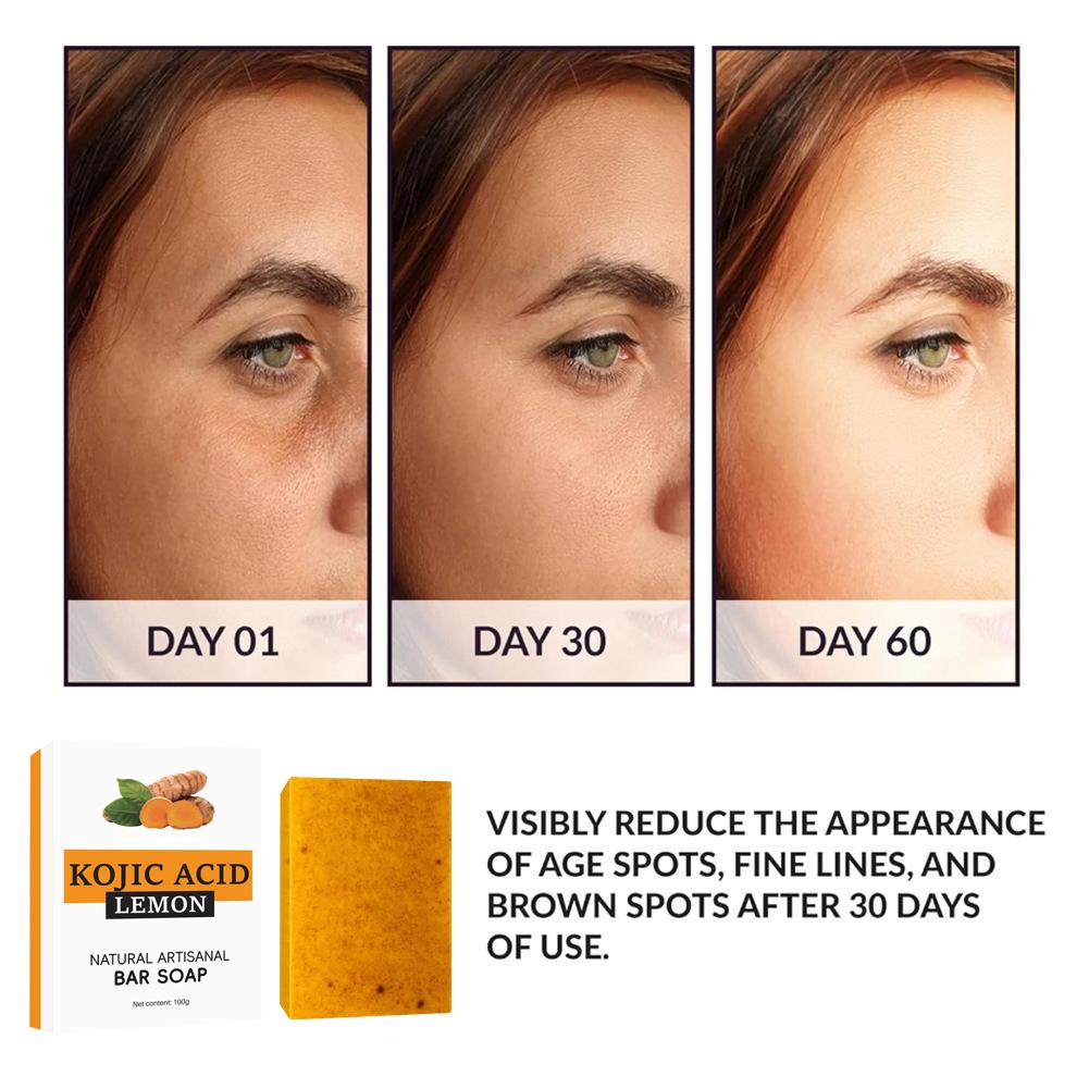 Newly upgrade Turmeric Kojic A - Kojic Acid Soap recension och pris