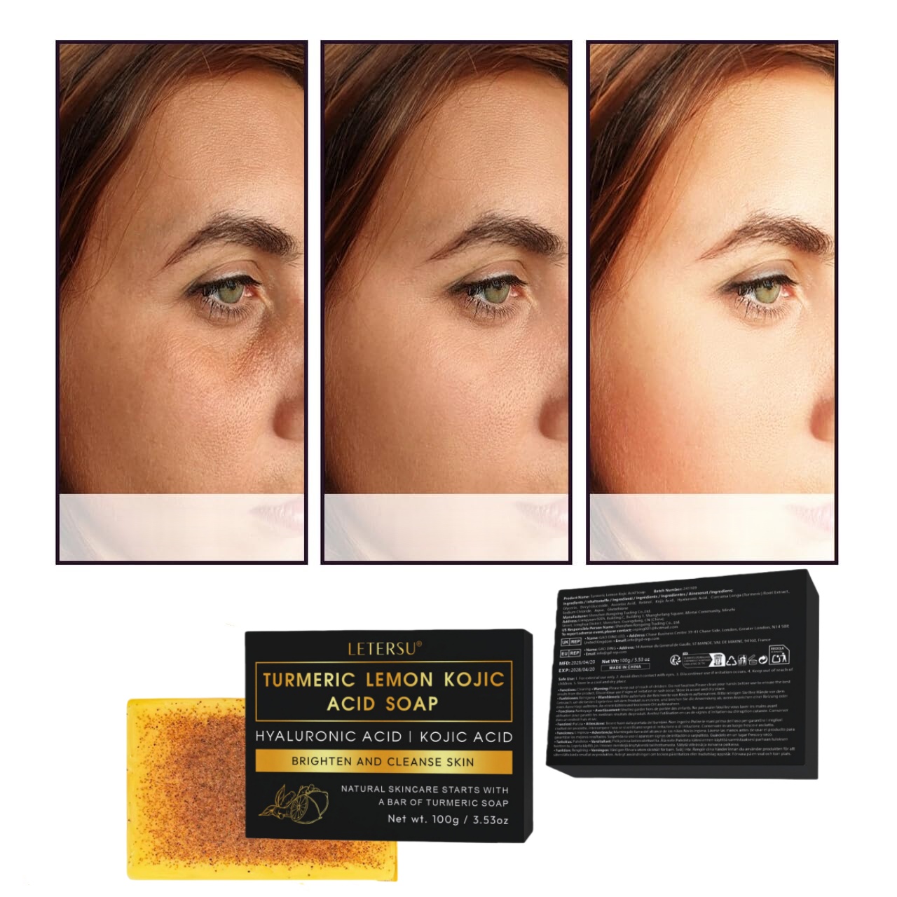 Turmeric Lemon Kojic Acid Soap - Kojic Acid Soap recension och pris