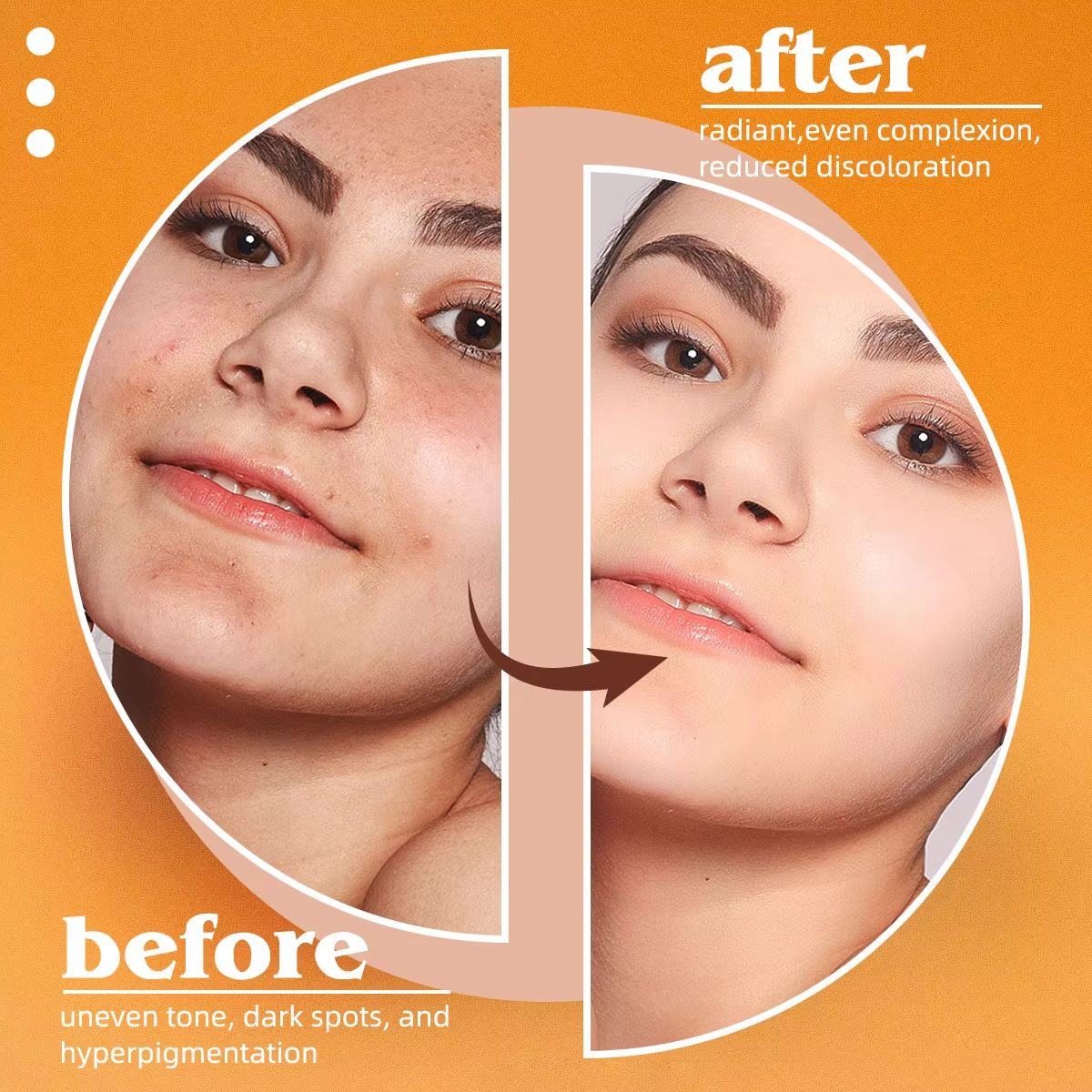 Kojic Acid Natural Papaya Soap - Kojic Acid Soap recension och pris
