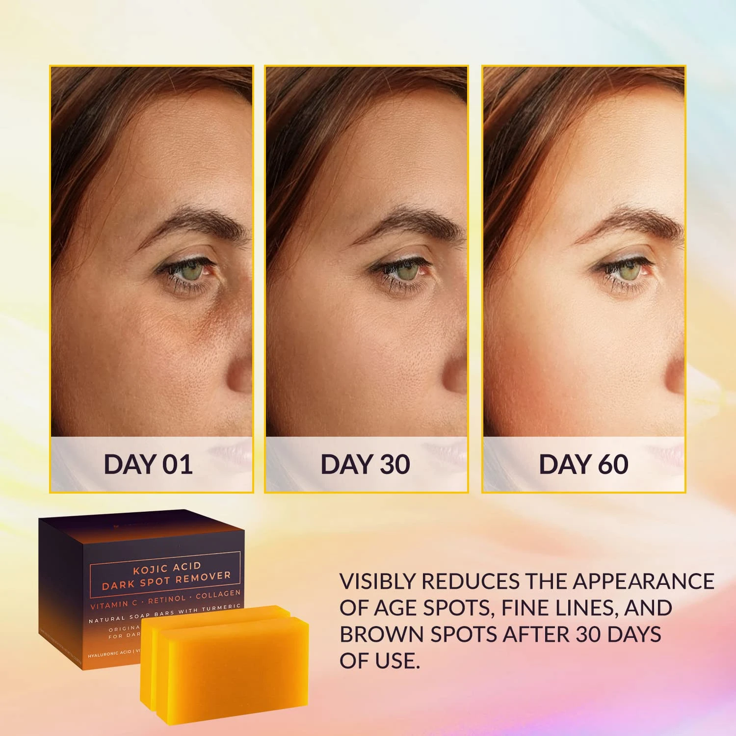 Kojic Acid Dark Spot Remover W - Kojic Acid Soap recension och pris