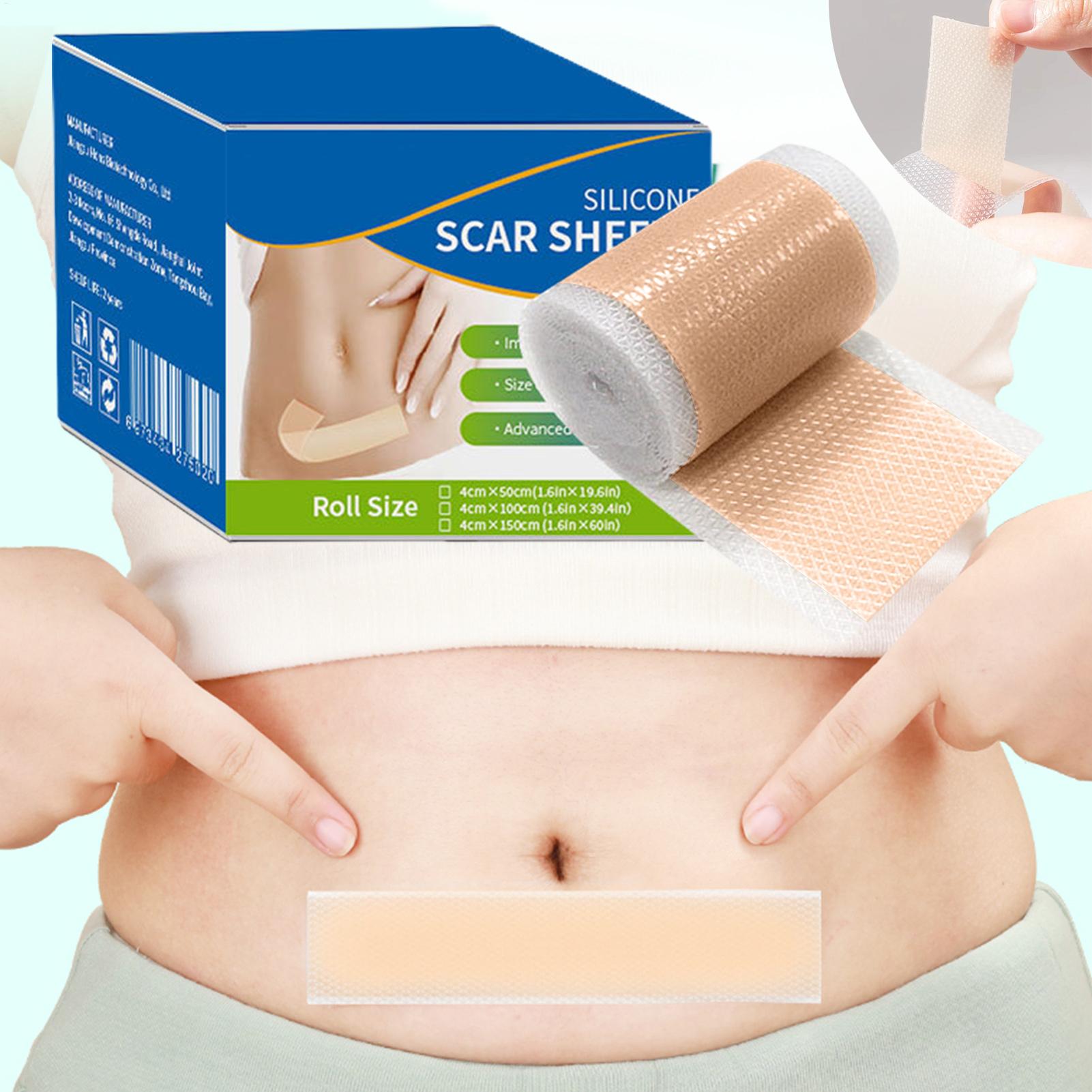 1 Roll Silicone Scar Sheets 4c - Collagen Sheet Mask recension och pris